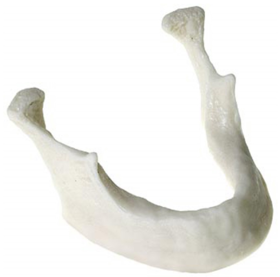 SALVIN 下顎無歯顎模型｜株式会社インプラテックスの取扱い商品