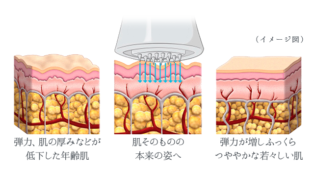 Dermatude DT-DM800 メタジェクト メタジェクト―エステの新たな