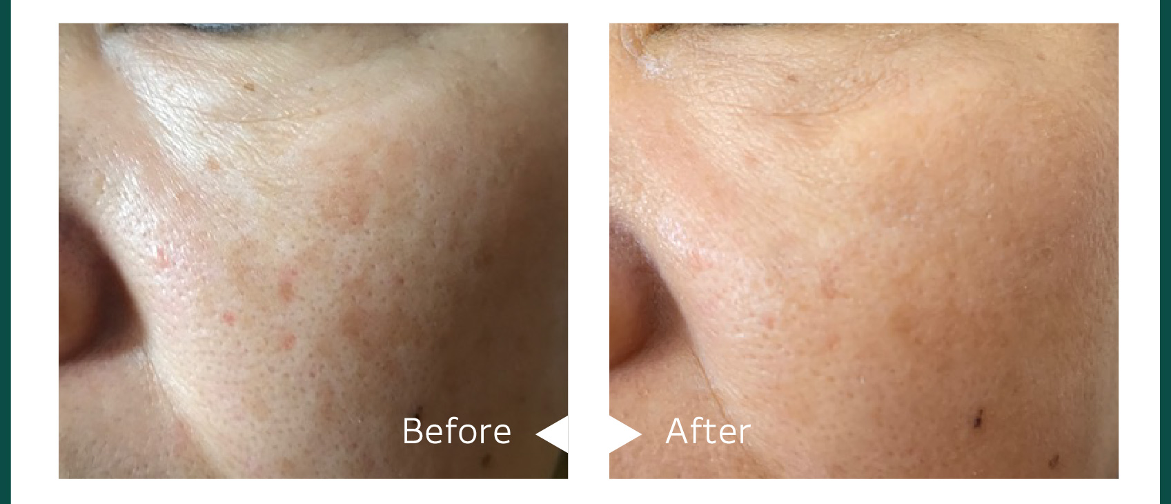 ZAC PACK｜DOC Skincare｜肌のチカラを高め、肌を育む。自宅でできる高