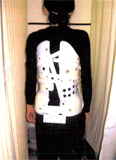 側湾症 【大塚整体治療院】 そくわん症 側わん症 側弯症