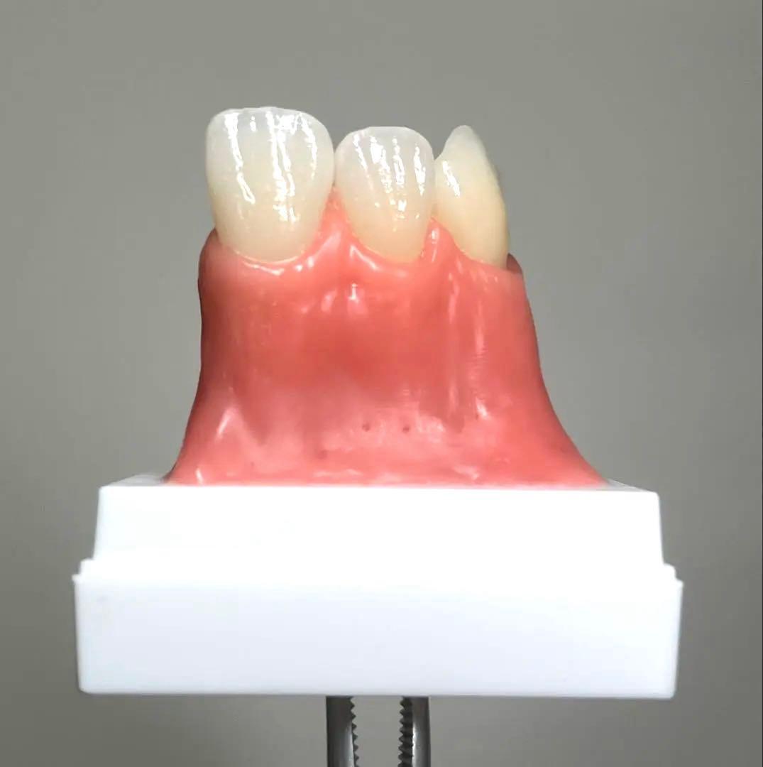 歯科 セラミックサンプル 擬似歯肉付き