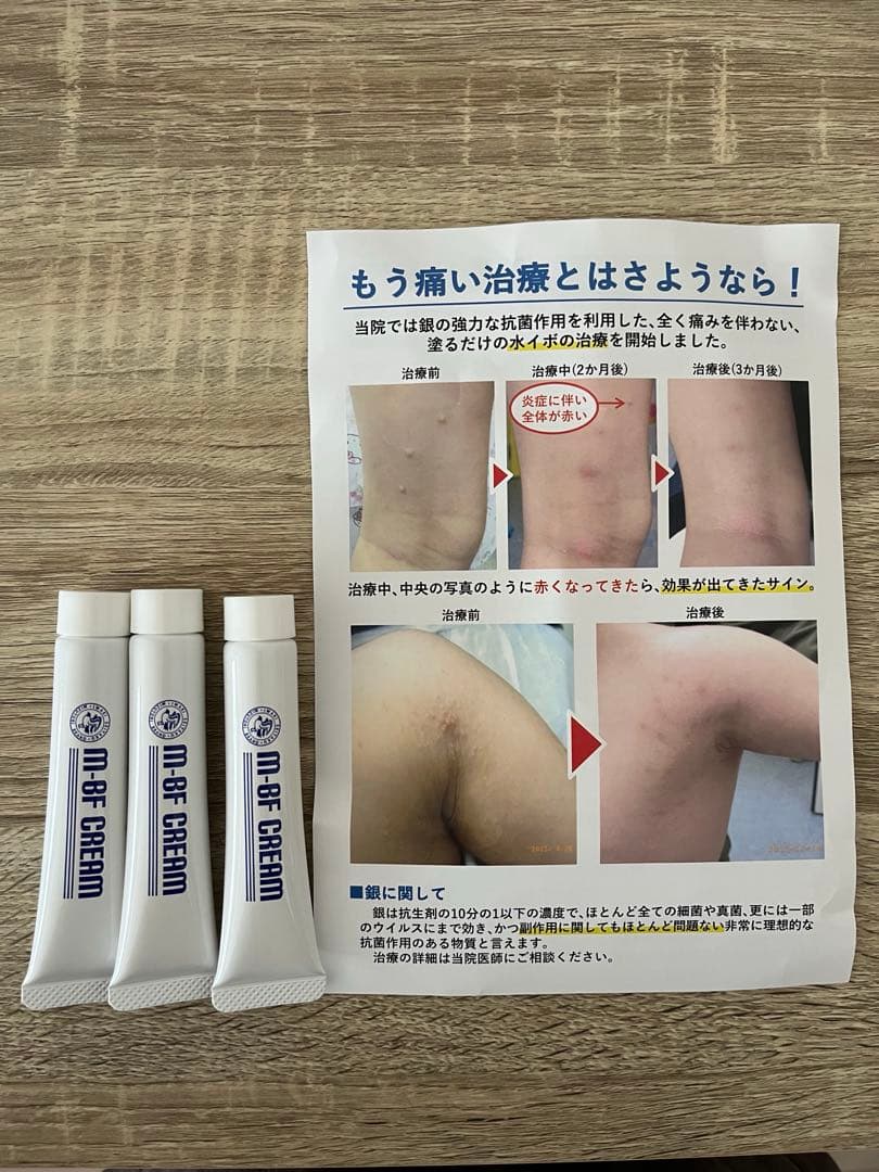 【未開封】m-BF-CREAM 3本セット　エムビーエフクリーム　水イボ 水イボ治療に3a MB-Fクリームを導入しました – 品川Vタワークリニック